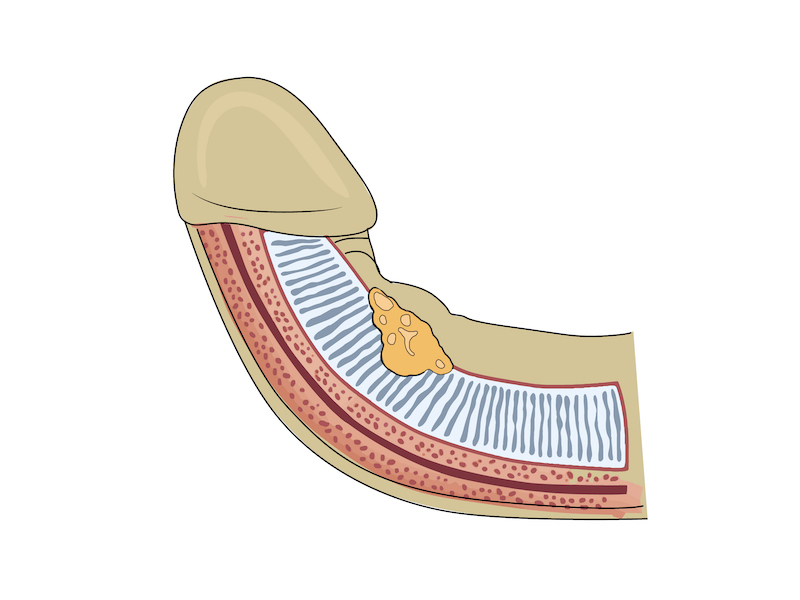 Cause illustration